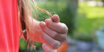 Psichologė paaiškina, kodėl plaukų retėjimas sukelia psichologines problemas