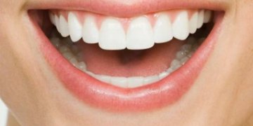 Dantų implantacija: privalumai