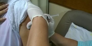 Specialistai: dažniausiai užduodami klausimai apie tymus