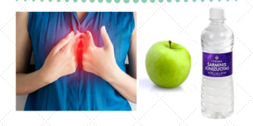 Kaip padėti sau gydyti refliuksą be cheminių vaistų