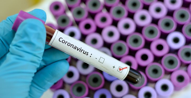 Coronavirus koronavirusas