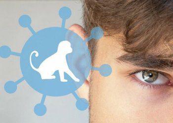 beždžionių raupai