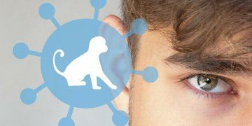 beždžionių raupai