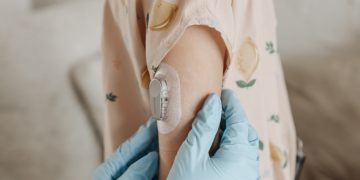 cukrausk kiekio kraujyje stebėjimas