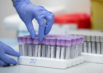 Svarbi žinia Vilniaus rajono gyventojams: grįžta laboratorinių tyrimų paslaugos