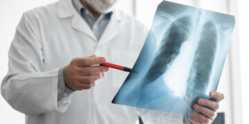 Vilniaus rajono gyventojų sveikata: 10 rodiklių geresni už šalies vidurkį